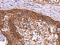 ABI1 Antibody – Figure 1 of 3