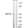 Western blot analysis of extracts from 3T3 cells, treated with starved (24hours), using MEF2C (Ab-396) antibody.