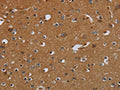 The image on the left is immunohistochemistry of paraffin-embedded Human brain tissue using CSB-PA961839(PCK2 Antibody) at dilution 1/60, on the right is treated with fusion protein. (Original magnification: ×200)