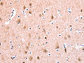 The image on the left is immunohistochemistry of paraffin-embedded Human brain tissue using CSB-PA962181(BMPR2 Antibody) at dilution 1/35, on the right is treated with fusion protein. (Original magnification: ×200)