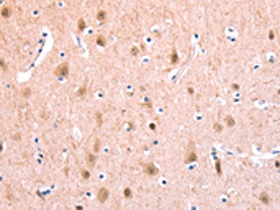 The image on the left is immunohistochemistry of paraffin-embedded Human brain tissue using CSB-PA962181(BMPR2 Antibody) at dilution 1/35, on the right is treated with fusion protein. (Original magnification: ×200)