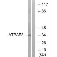 Western blot analysis of extracts from Jurkat cells, using ATPAF2 antibody.