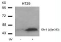 Western blot analysis of extracts from HT29 cells untreated or treated with UV using Elk-1(Phospho-Ser383) Antibody.