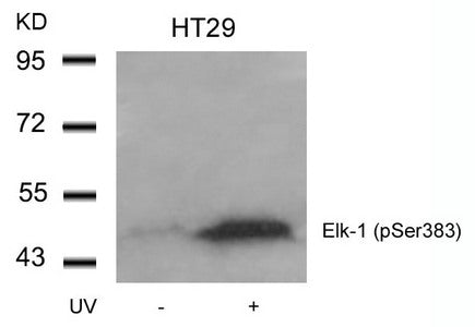 Western blot analysis of extracts from HT29 cells untreated or treated with UV using Elk-1(Phospho-Ser383) Antibody.