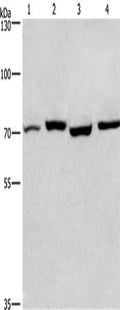 Gel: 6%SDS-PAGE, Lysate: 40 ug, Lane 1-4: Human fetal liver tissue, mouse stomach tissue, hela cells, hepG2 cells, Primary antibody: CSB-PA962780(ARNTL Antibody) at dilution 1/450, Secondary antibody: Goat anti rabbit IgG at 1/8000 dilution, Exposure time: 20 seconds