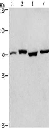 Gel: 6%SDS-PAGE, Lysate: 40 ug, Lane 1-4: Human fetal liver tissue, mouse stomach tissue, hela cells, hepG2 cells, Primary antibody: CSB-PA962780(ARNTL Antibody) at dilution 1/450, Secondary antibody: Goat anti rabbit IgG at 1/8000 dilution, Exposure time: 20 seconds