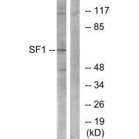 Western blot analysis of extracts from COLO205 cells, using SF1 (Ab-82) antibody.