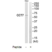 Western blot analysis of extracts from HeLa cells, using CCT7 antibody.