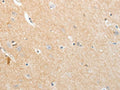 The image on the left is immunohistochemistry of paraffin-embedded Human brain tissue using CSB-PA963250(APLNR Antibody) at dilution 1/20, on the right is treated with fusion protein. (Original magnification: ×200)