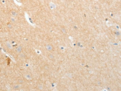 The image on the left is immunohistochemistry of paraffin-embedded Human brain tissue using CSB-PA963250(APLNR Antibody) at dilution 1/20, on the right is treated with fusion protein. (Original magnification: ×200)