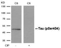 Western blot analysis of extracts from C6 cells, treated with calf intestinal phosphatase (CIP), using Tau (Phospho-Ser404) Antibody.