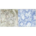 Immunohistochemistry analysis of paraffin-embedded human colon carcinoma tissue using CST1 antibody.