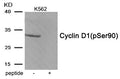 Western blot analysis of extracts from K562 tissue using Cyclin D1 (Phospho-Ser90) antibody.The lane on the right is treated with the antigen-specific peptide.