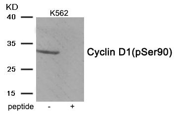 Western blot analysis of extracts from K562 tissue using Cyclin D1 (Phospho-Ser90) antibody.The lane on the right is treated with the antigen-specific peptide.