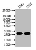 Western Blot
Positive WB detected in: A549 whole cell lysate, SY5Y whole cell lysate
All lanes: CXCL16 antibody at 1:1000
Secondary
Goat polyclonal to rabbit IgG at 1/50000 dilution
Predicted band size: 28 kDa
Observed band size: 28 kDa