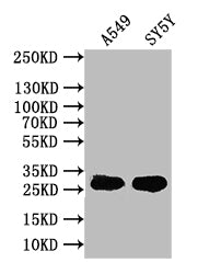 Western Blot
Positive WB detected in: A549 whole cell lysate, SY5Y whole cell lysate
All lanes: CXCL16 antibody at 1:1000
Secondary
Goat polyclonal to rabbit IgG at 1/50000 dilution
Predicted band size: 28 kDa
Observed band size: 28 kDa