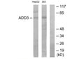 Western blot analysis of extracts from HepG2 cells and 293 cells, using ADD3 antibody.