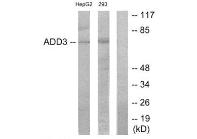 Western blot analysis of extracts from HepG2 cells and 293 cells, using ADD3 antibody.