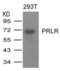 Western blot analysis of extracts from 293T cells expressing human PRLR protein using PRLR Antibody.