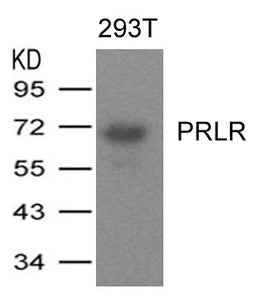 Western blot analysis of extracts from 293T cells expressing human PRLR protein using PRLR Antibody.