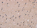 The image on the left is immunohistochemistry of paraffin-embedded Human brain tissue using CSB-PA965968(KIAA1324 Antibody) at dilution 1/40, on the right is treated with fusion protein. (Original magnification: ×200)