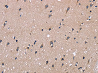 The image on the left is immunohistochemistry of paraffin-embedded Human brain tissue using CSB-PA965968(KIAA1324 Antibody) at dilution 1/40, on the right is treated with fusion protein. (Original magnification: ×200)