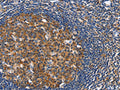 The image on the left is immunohistochemistry of paraffin-embedded Human tonsil tissue using CSB-PA966396(CEP97 Antibody) at dilution 1/40, on the right is treated with fusion protein. (Original magnification: ×200)