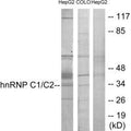 Western blot analysis of extracts from HepG2 cells and COLO205 cells, using hnRNP C1/C2 antibody.