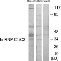 Western blot analysis of extracts from HepG2 cells and COLO205 cells, using hnRNP C1/C2 antibody.