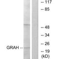 Western blot analysis of extracts from K562 cells, using GRAH antibody.