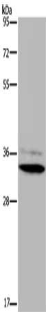 Gel: 8%SDS-PAGE, Lysate: 40 ug, Lane: Human testis tissue, Primary antibody: CSB-PA966845(HSD17B7 Antibody) at dilution 1/200, Secondary antibody: Goat anti rabbit IgG at 1/8000 dilution, Exposure time: 10 minutes