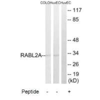 Western blot analysis of extracts from HuvEc and COLO205 cells, using RABL2A antibody.