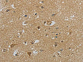 The image on the left is immunohistochemistry of paraffin-embedded Human brain tissue using CSB-PA967591(NPHS1 Antibody) at dilution 1/40, on the right is treated with synthetic peptide. (Original magnification: ×200)