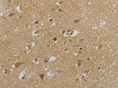 The image on the left is immunohistochemistry of paraffin-embedded Human brain tissue using CSB-PA967591(NPHS1 Antibody) at dilution 1/40, on the right is treated with synthetic peptide. (Original magnification: ×200)
