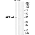 Western blot analysis of extracts from COLO205 cells and NIH-3T3 cells, using AKR1A1 antibody.