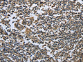 The image on the left is immunohistochemistry of paraffin-embedded Human tonsil tissue using CSB-PA968257(PRDX6 Antibody) at dilution 1/25, on the right is treated with fusion protein. (Original magnification: ×200)
