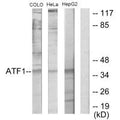 Western blot analysis of extracts from COLO205 cells, HeLa cells and HepG2 cells, using ATF1 antibody.