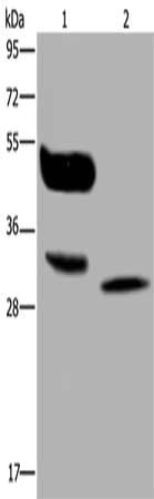 Gel: 10%SDS-PAGE, Lysate: 40 ug, Lane 1-2: A375 cells, human lung cancer tissue, Primary antibody: CSB-PA968714(MAGEA8 Antibody) at dilution 1/400, Secondary antibody: Goat anti rabbit IgG at 1/8000 dilution, Exposure time: 30 seconds