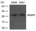 Western blot analysis of extracts from A549, A431 cells using WISP2 Antibody.