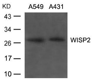 Western blot analysis of extracts from A549, A431 cells using WISP2 Antibody.