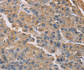 PMAIP1 Antibody – Figure 1 of 2