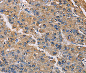 PMAIP1 Antibody – Figure 1 of 2