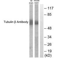 Western blot analysis of extracts from rat cells and mouse brain cells, using Tubulin β antibody.