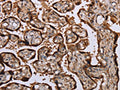 The image on the left is immunohistochemistry of paraffin-embedded Human placenta tissue using CSB-PA969739(KIF1C Antibody) at dilution 1/60, on the right is treated with fusion protein. (Original magnification: ×200)
