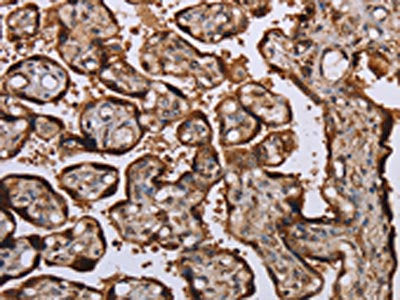 The image on the left is immunohistochemistry of paraffin-embedded Human placenta tissue using CSB-PA969739(KIF1C Antibody) at dilution 1/60, on the right is treated with fusion protein. (Original magnification: ×200)