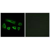 Immunofluorescence analysis of A549 cells, using NT5C1B antibody.