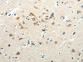 The image on the left is immunohistochemistry of paraffin-embedded Human brain tissue using CSB-PA970317(SCG3 Antibody) at dilution 1/25, on the right is treated with fusion protein. (Original magnification: ×200)