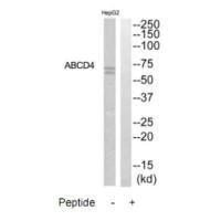 Western blot analysis of extracts from HepG2 cells, using ABCD4 antibody.