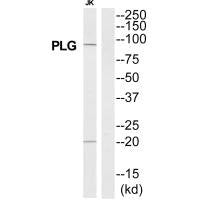 Western blot analysis of extracts from Jurkat cells, using PLG antibody.