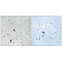 Immunohistochemistry analysis of paraffin-embedded human brain tissue using OXR1 antibody.
